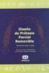 Diseo de prtesis parcial removible