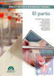 El parto