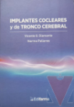 Implantes cocleares y de Tronco Cerebral